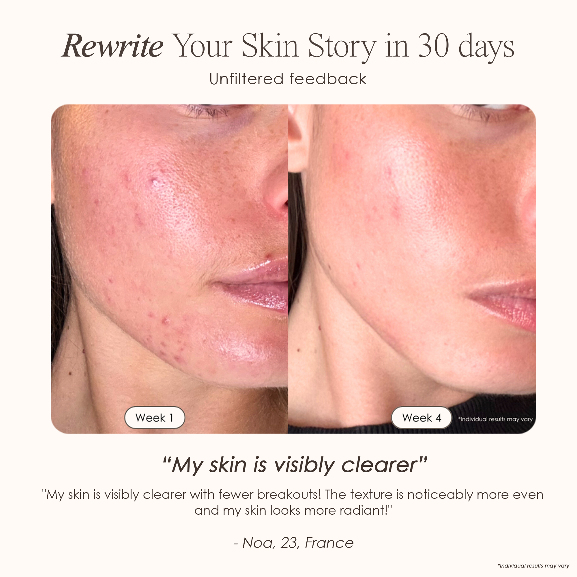 visible results after 4 weeks of using the LED light therapy mask