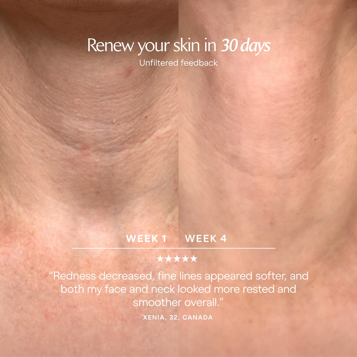 LumaLux Face+ | Pro LED Red Light Therapy Face & Neck Mask - Project E Beauty