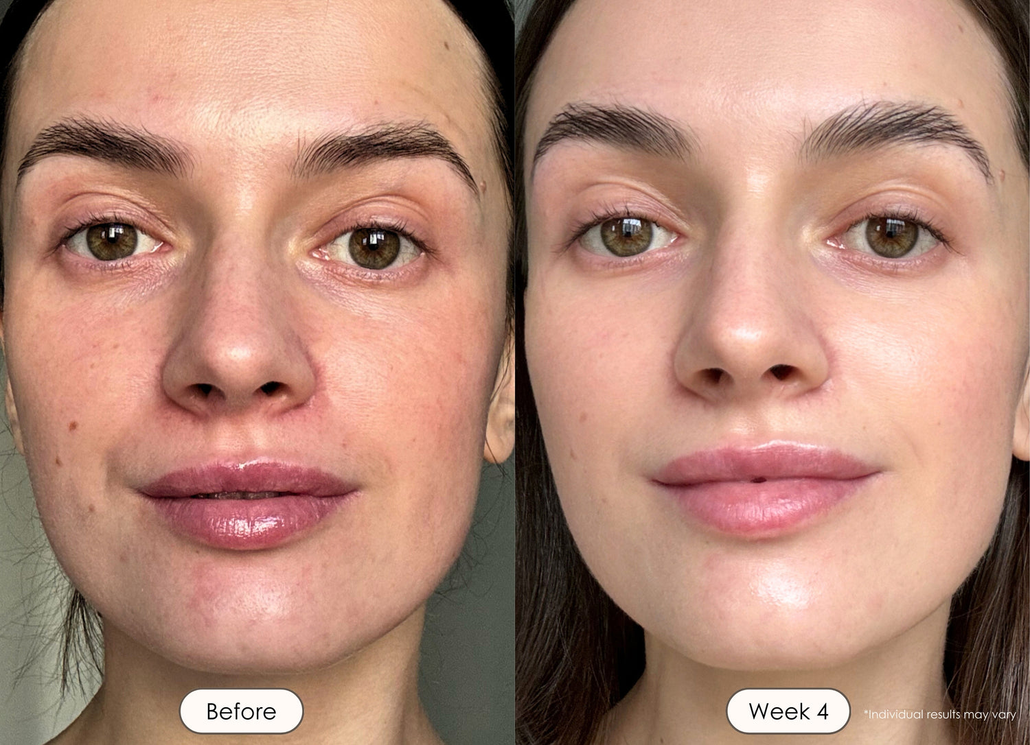 visible results after 4 weeks of using the LED light therapy mask